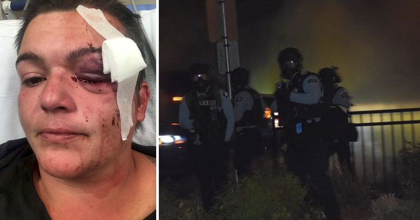 Photographer Sues Police for Blinding Her Left Eye, Uses Last Photo as Proof